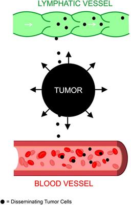 The ambivalent nature of the relationship between lymphatics and cancer